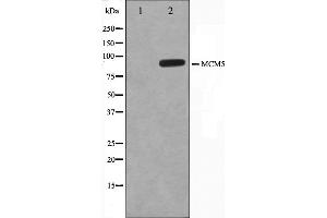 Western blot analysis on HepG2 cell lysate using MCM5 Antibody. (MCM5 antibody  (N-Term))