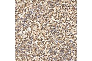 IHC analysis of Citrin/SLC25A13 using anti-Citrin/SLC25A13 antibody (ABIN7599512). (slc25a13 antibody  (AA 1-643))