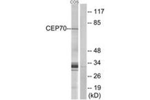 Western blot analysis of extracts from COS cells, using CEP70 Antibody.