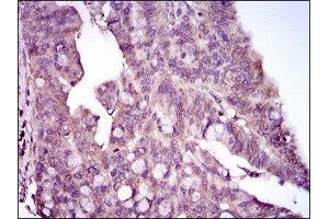 Immunohistochemistry (IHC) image for anti-Mitogen-Activated Protein Kinase 14 (MAPK14) (AA 299-360) antibody (ABIN1845584) (MAPK14 antibody  (AA 299-360))