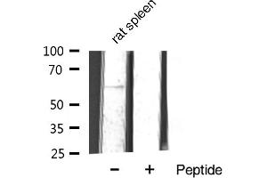Western blot analysis of TGFBR2 expression in rat spleen tissue. (TGFBR2 antibody  (Internal Region))