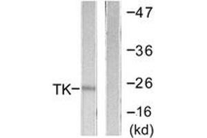 Western blot analysis of extracts from COLO205 cells, using TK (Ab-13) Antibody. (TK (AA 1-50) antibody)