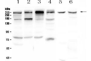 Western blot analysis of IGF2R using anti-IGF2R antibody .