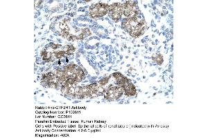 Human kidney (GTF2H1 antibody  (N-Term))