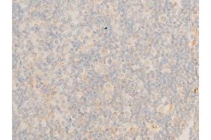 Immunohistochemistry (IHC) image for anti-Nuclear Factor of kappa Light Polypeptide Gene Enhancer in B-Cells Inhibitor, epsilon (NFKBIE) (pSer161) antibody (ABIN6255101)