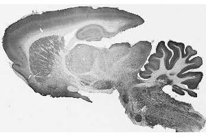 Adult rat brain immunohistochemistry. (TMEM91 antibody  (Cytosolic, N-Term))