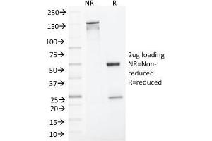 SDS-PAGE Analysis Purified MLH1 Mouse Monoclonal Antibody (MLH1/1324).