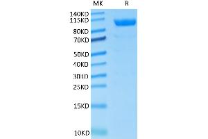 CDCP1 Protein (His tag)