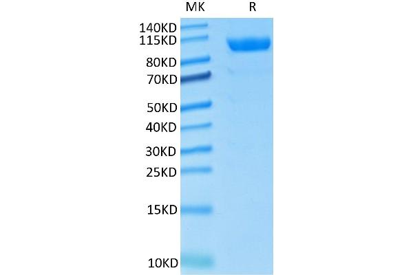 CDCP1 Protein (His tag)