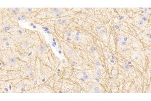 Immunohistochemistry (IHC) image for anti-Tubulin, beta 1 (TUBB1) (AA 182-437) antibody (ABIN7435847)