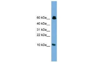 WB Suggested Anti-SUPT4H1 Antibody Titration: 0. (SUPT4H antibody  (Middle Region))