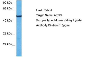Host:  Mouse  Target Name:  ATP5B  Sample Tissue:  Mouse Kidney  Antibody Dilution:  1ug/ml (ATP5B antibody  (N-Term))