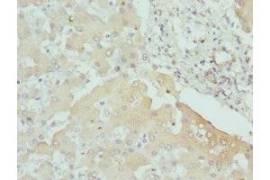 Immunohistochemistry of paraffin-embedded human liver tissue using ABIN7146779 at dilution of 1:100 (CPN1 antibody  (AA 209-458))