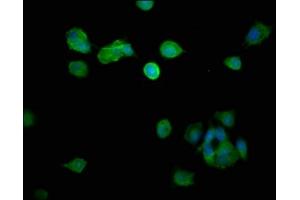 Immunofluorescence staining of MCF-7 cells with ABIN7150805 at 1:266, counter-stained with DAPI. (Dynamitin antibody  (AA 1-252))