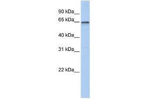 WB Suggested Anti-AHCYL1 Antibody Titration: 0. (AHCYL1 antibody  (N-Term))