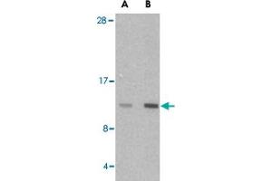 Western blot analysis of HRK in mouse pancreas tissue lysate with HRK polyclonal antibody  at (A) 2. (HRK antibody  (Internal Region))