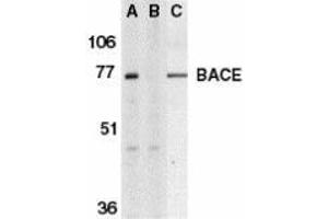 Western blot analysis of BACE in human brain tissue lysate in the absence (A) or presence (B) of blocking peptide and in mouse 3T3 cell lysate (C) with AP30111PU-N BACE antibody at 1 μg/ml. (BACE1 antibody  (C-Term))