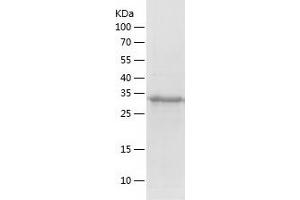 Western Blotting (WB) image for General Transcription Factor IIB (GTF2B) (AA 1-316) protein (His tag) (ABIN7286887) (GTF2B Protein (AA 1-316) (His tag))