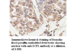 Image no. 1 for anti-Sterol Carrier Protein 2 (SCP2) antibody (ABIN791185) (SCP2 antibody)