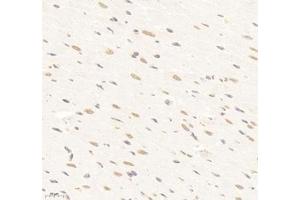 Immunohistochemistry of paraffin embedded rat heart using SUPT3H (ABIN7075767) at dilution of 1: 1500 (400x lens)