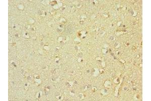 Immunohistochemistry of paraffin-embedded human brain tissue using ABIN7161335 at dilution of 1:100 (TACR3 antibody  (AA 356-465))