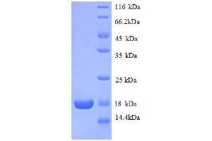 Ribosomal Protein L31 (RPL31) (AA 1-125), (full length) protein (His tag)