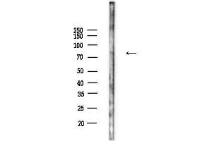 anti-Sema Domain, Immunoglobulin Domain (Ig), Short Basic Domain, Secreted, (Semaphorin) 3A (SEMA3A) (C-Term) antibody