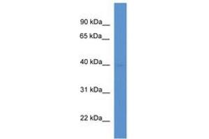 Image no. 1 for anti-Mitochondrial Carrier 1 (MTCH1) (AA 157-206) antibody (ABIN6746278) (MTCH1 antibody  (AA 157-206))