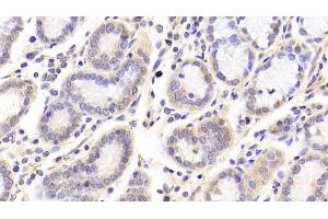 Detection of SIRT3 in Human Stomach Tissue using Polyclonal Antibody to Sirtuin 3 (SIRT3) (SIRT3 antibody  (AA 126-399))
