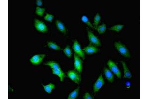 Immunofluorescent analysis of Hela cells using ABIN7162111 at dilution of 1:100 and Alexa Fluor 488-congugated AffiniPure Goat Anti-Rabbit IgG(H+L) (OLA1 antibody  (AA 1-396))