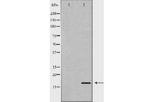Western blot analysis of extracts of mouse liver, using ANG antibody. (ANG antibody  (Internal Region))