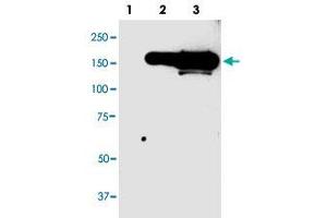 Western blot analysis of CFP monoclonal antibody, clone 98s55  in 10 ug lysate from GFP fusion protein prositive 293 cells. (CFP antibody  (N-Term))