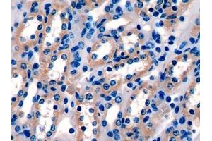 #VALUE! (PIGR antibody  (AA 463-563))