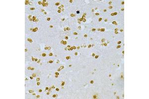 Immunohistochemistry of paraffin-embedded mouse brain using DKC1 Antibody (ABIN5970956) at dilution of 1/200 (40x lens). (DKC1 antibody)