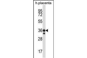 Western blot analysis in human placenta tissue lysates (35ug/lane). (STK26/MST4 antibody  (AA 271-299))