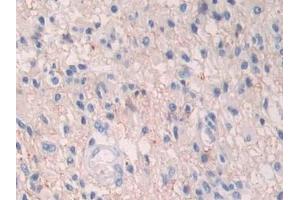 Immunohistochemistry (IHC) image for anti-Hypoxia Inducible Factor 1, alpha Subunit (Basic Helix-Loop-Helix Transcription Factor) (HIF1A) (AA 218-506) antibody (ABIN7439318)