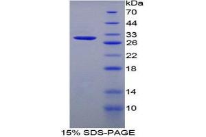 SDS-PAGE (SDS) image for Chondroitin Sulfate Proteoglycan 5 (Neuroglycan C) (CSPG5) (AA 139-370) protein (His tag) (ABIN2124326)
