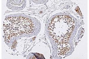 Immunohistochemical staining with TRIM29 polyclonal antibody  in normal testis tissue at 1 : 100 dilution. (TRIM29 antibody  (AA 569-583))