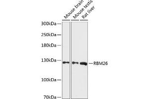 Western blot analysis of extracts of various cell lines, using RBM26 antibody (ABIN6130214, ABIN6146770, ABIN6146772 and ABIN6216994) at 1:3000 dilution. (RBM26 antibody  (AA 65-140))