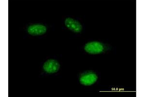 Immunofluorescence of purified MaxPab antibody to THAP11 on HeLa cell.