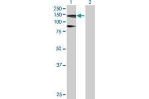 Western Blot analysis of HIP1R expression in transfected 293T cell line by HIP1R MaxPab polyclonal antibody.