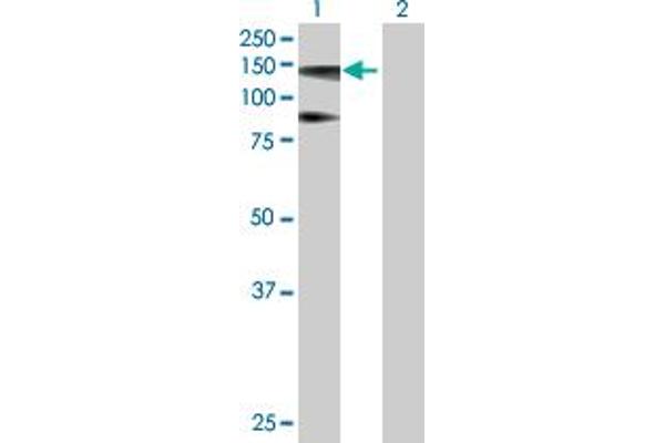 HIP1R antibody  (AA 1-1068)