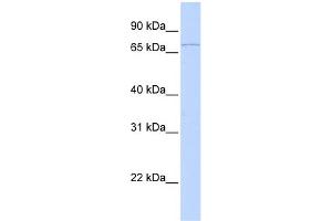 WB Suggested Anti-RNF6 Antibody Titration:  0. (RNF6 antibody  (C-Term))