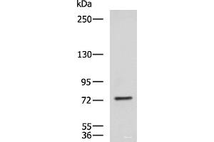 Western blot analysis of NIH/3T3 cell lysate using KIF2A Polyclonal Antibody at dilution of 1:850 (KIF2A antibody)