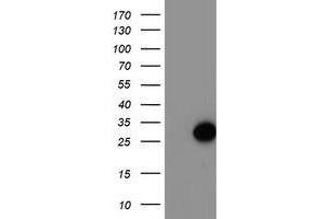 HEK293T cells were transfected with the pCMV6-ENTRY control (Left lane) or pCMV6-ENTRY ARL11 (Right lane) cDNA for 48 hrs and lysed. (ARL11 antibody)