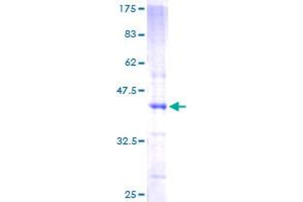 E2F3 Protein (AA 1-133) (GST tag)
