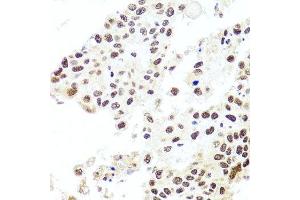 Immunohistochemistry (Paraffin-embedded Sections) (IHC (p)) image for anti-HIR Histone Cell Cycle Regulation Defective Homolog A (HIRA) (AA 250-550) antibody (ABIN6141776)