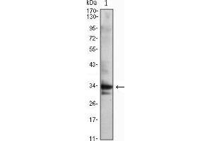 Western blot analysis using CDC2 mouse mAb against Jurkat (1) cell lysate. (CDK1 antibody)