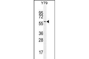 LENG9 Antibody (N-term) (ABIN655202 and ABIN2844817) western blot analysis in Y79 cell line lysates (35 μg/lane). (LENG9 antibody  (N-Term))