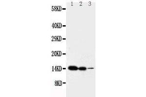 Anti-IL2 antibody, Western blotting Lane 1: Recombinant Mouse IL2 Protein 10ng Lane 2: Recombinant Mouse IL2 Protein 5ng Lane 3: Recombinant Mouse IL2 Protein 2. (IL-2 antibody  (C-Term))